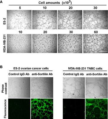 New Peptide-Drug Conjugates for Precise Targeting of SORT1-Mediated Vasculogenic Mimicry in the Tumor Microenvironment of TNBC-Derived MDA-MB-231 Breast and Ovarian ES-2 Clear Cell Carcinoma Cells